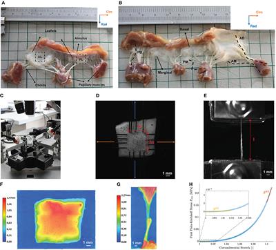 Alterations in Human Mitral Valve Mechanical Properties Secondary to Left Ventricular Remodeling: A Biaxial Mechanical Study